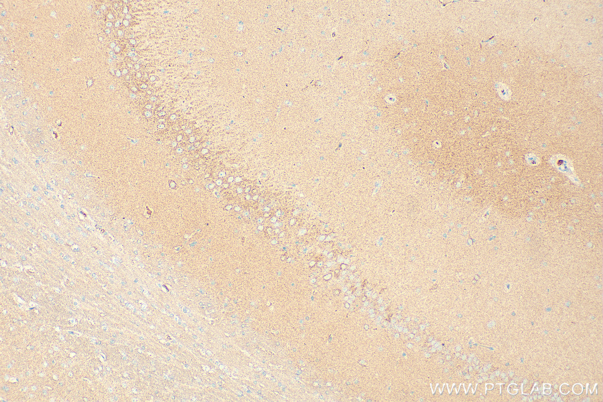 Immunohistochemical analysis of paraffin-embedded rat brain tissue slide using 13152-1-AP (GDAP1 antibody) at dilution of 1:400 (under 10x lens). Heat mediated antigen retrieval with Tris-EDTA buffer (pH 9.0). IHC staining of rat brain using 13152-1-AP