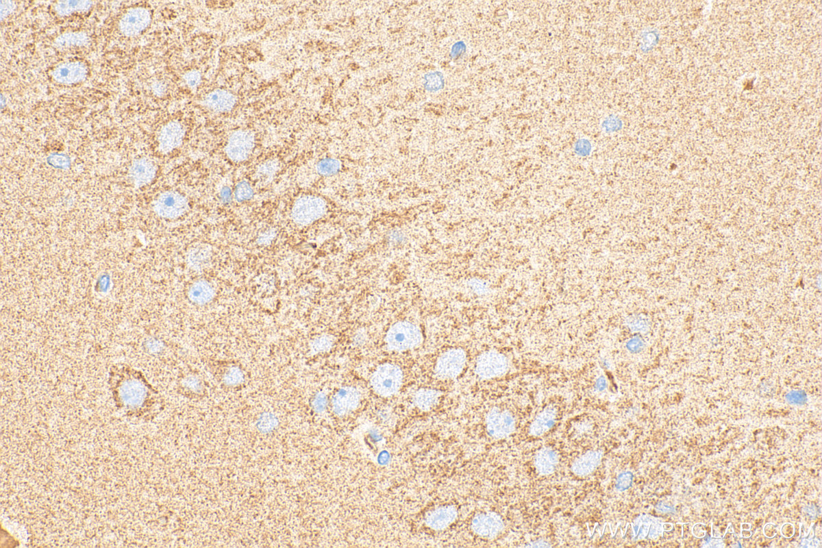 Immunohistochemical analysis of paraffin-embedded rat brain tissue slide using 13152-1-AP (GDAP1 antibody) at dilution of 1:400 (under 40x lens). Heat mediated antigen retrieval with Tris-EDTA buffer (pH 9.0). IHC staining of rat brain using 13152-1-AP