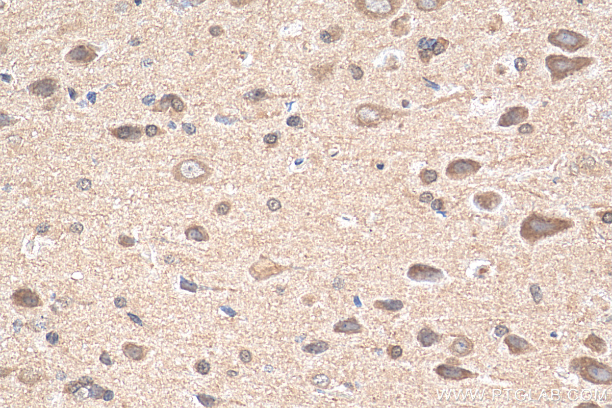 IHC staining of rat brain using 68083-1-Ig