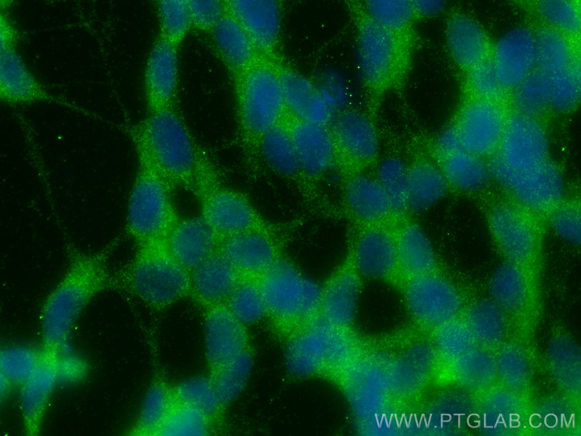 Immunofluorescent analysis of (-20°C Ethanol) fixed SH-SY5Y cells using GDAP1L1 antibody (<a class='green' href='/productredirect?CatalogNo=68340-1-Ig' target='_blank'>68340-1-Ig</a>, Clone: 1C7A3 ) at dilution of 1:400 and Multi-rAb CoraLite ® Plus 488-Goat Anti-Mouse Recombinant Secondary Antibody (H+L) (RGAM002). This data was developed using the same antibody clone with 68340-1-PBS in a different storage buffer formulation. IF Staining of SH-SY5Y using 68340-1-Ig (same clone as 68340-1-PBS)