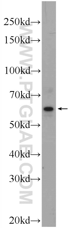 Raji cells were subjected to SDS PAGE followed by western blot with 17246-1-AP (GDAP2 Antibody) at dilution of 1:1000  incubated at 4 degree celsius over night. WB analysis of Raji using 17246-1-AP
