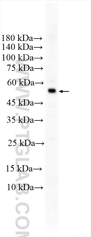 WB analysis of Raji using 17246-1-AP
