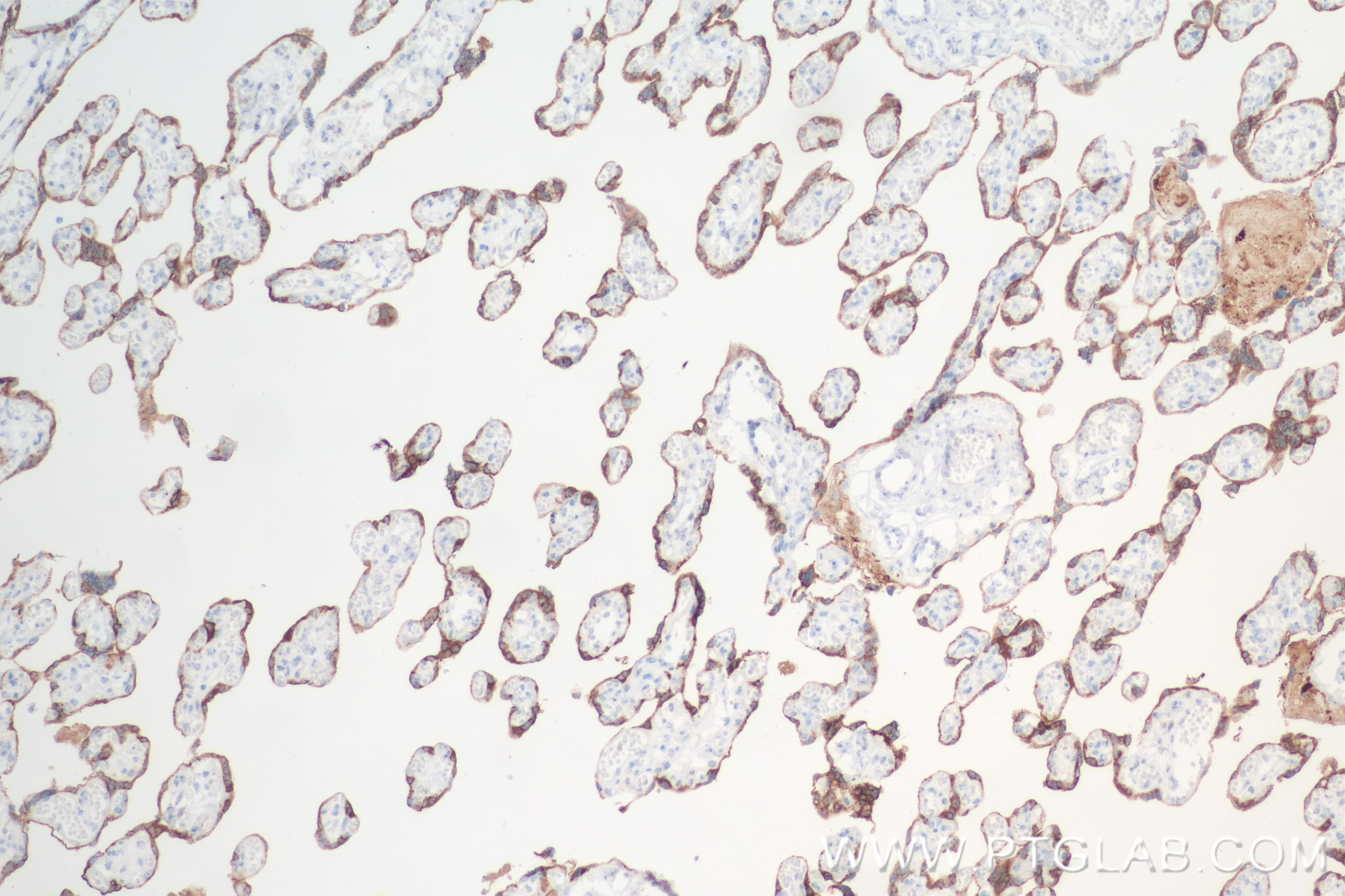 IHC staining of human placenta using 85100-1-RR (same clone as 85100-1-PBS)