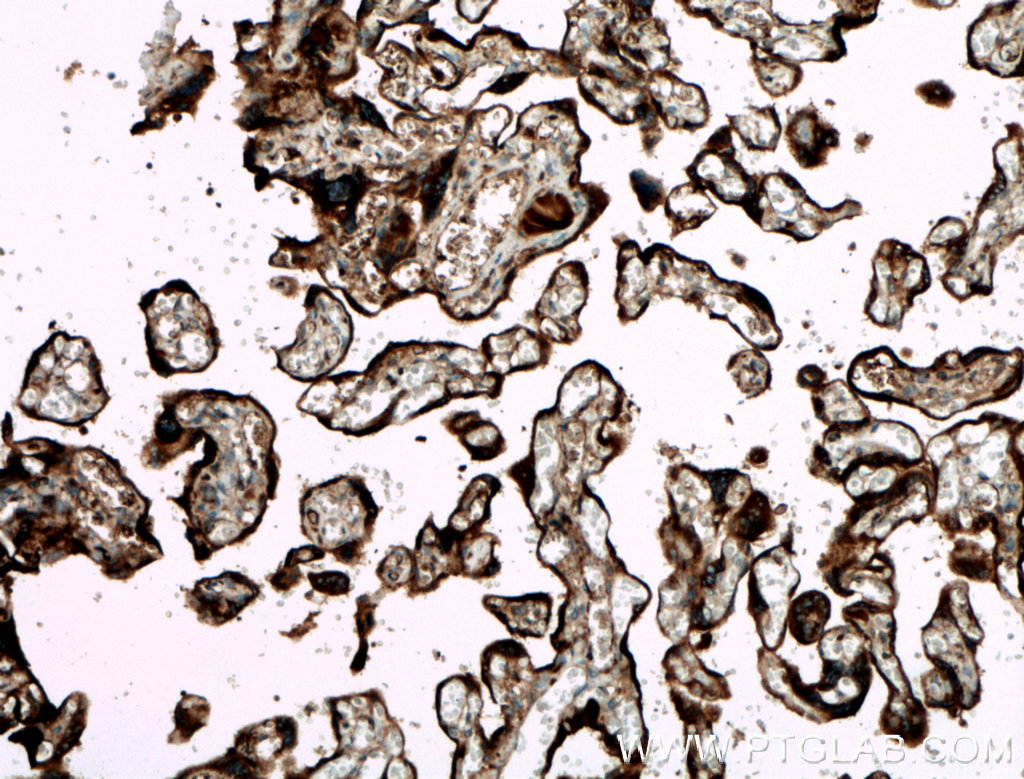 IHC staining of human placenta using 27455-1-AP