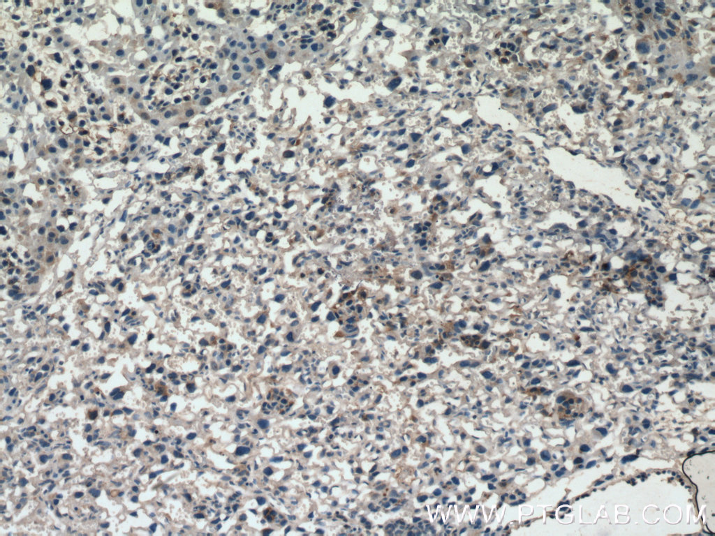 GDF-15