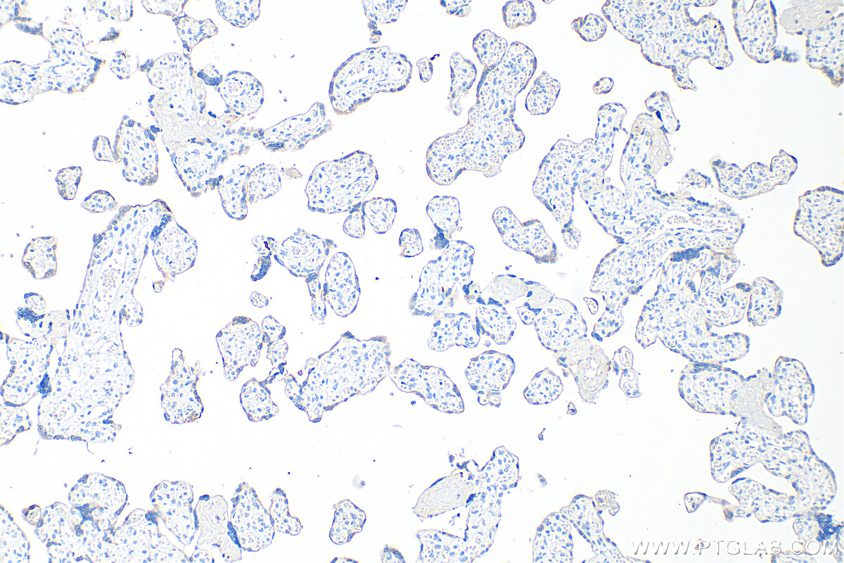 IHC staining of human placenta using 68768-1-Ig