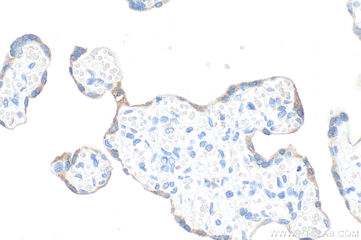 IHC staining of human placenta using 68768-1-Ig