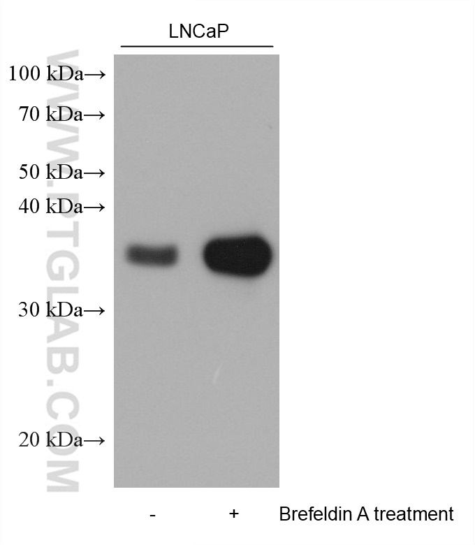 GDF-15