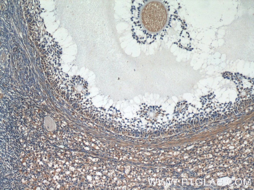 IHC staining of human ovary using 19894-1-AP