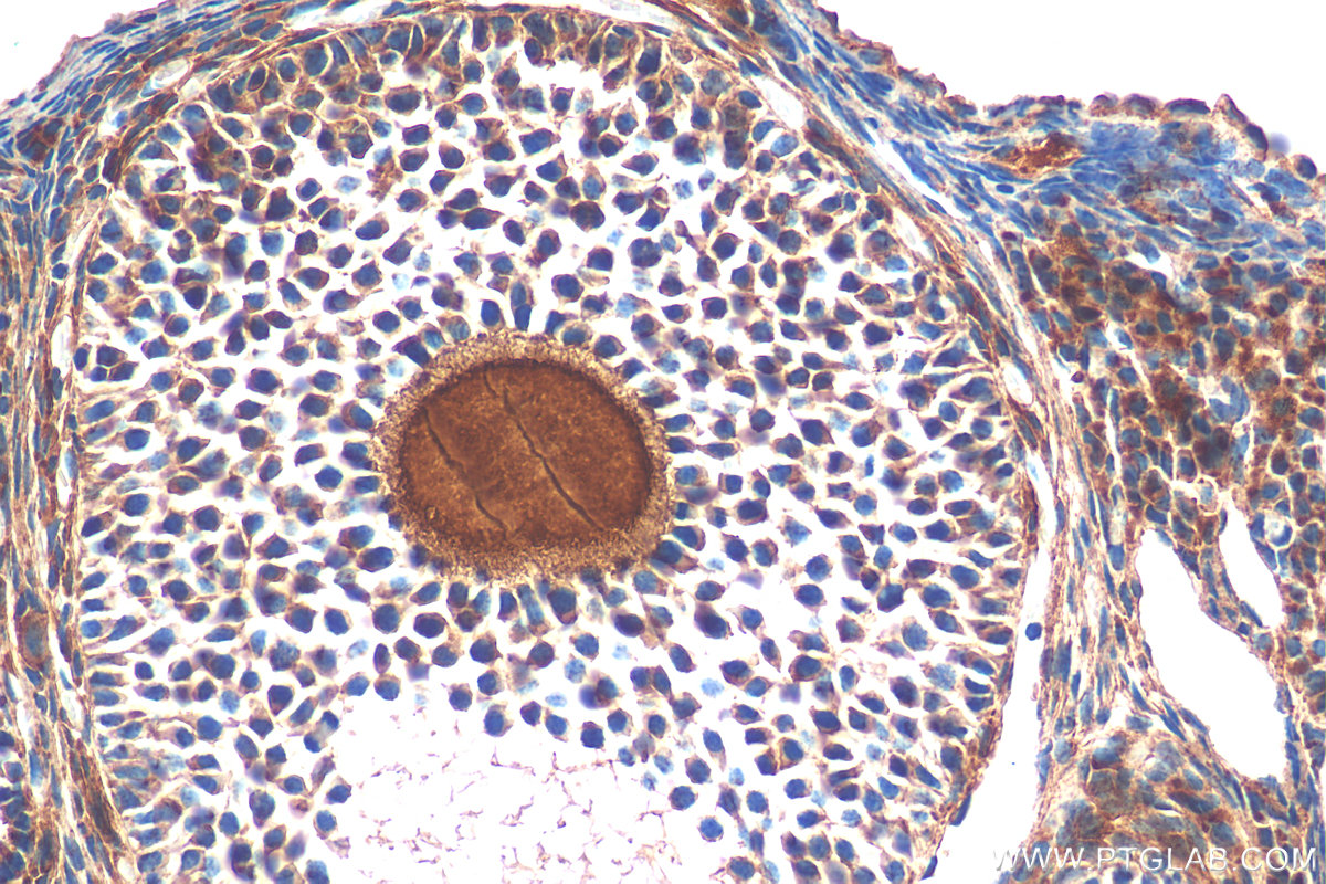 IHC staining of mouse ovary using 29309-1-AP