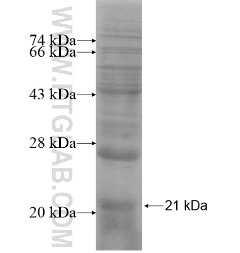 GDF9 fusion protein Ag13861 SDS-PAGE GDF9 fusion protein Ag13861 SDS-PAGE