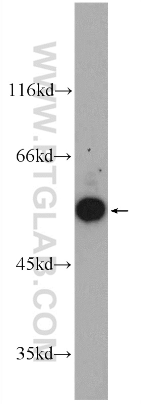 WB analysis of mouse brain using 10249-1-AP