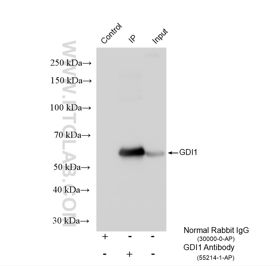 IP experiment of SH-SY5Y using 55214-1-AP