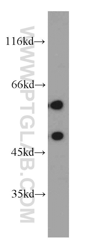 WB analysis of SH-SY5Y using 55214-1-AP