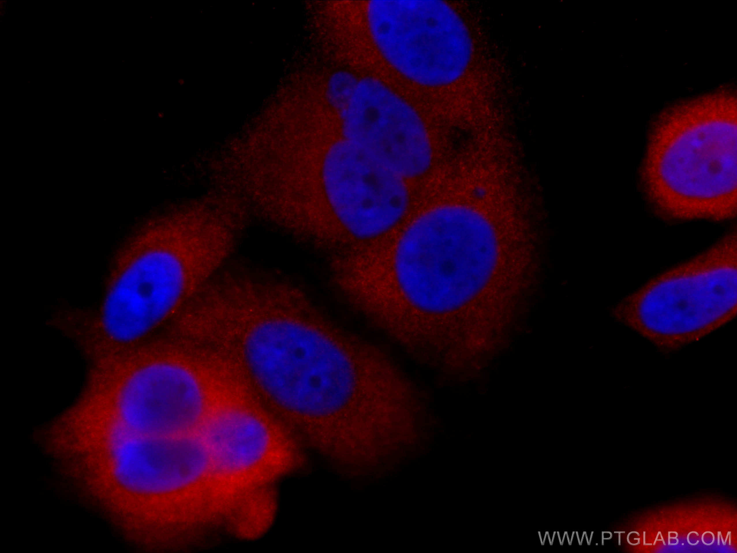 IF Staining of MCF-7 using CL594-66434