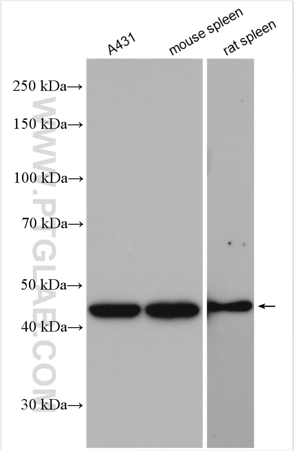 WB analysis of A431 using 10116-1-AP