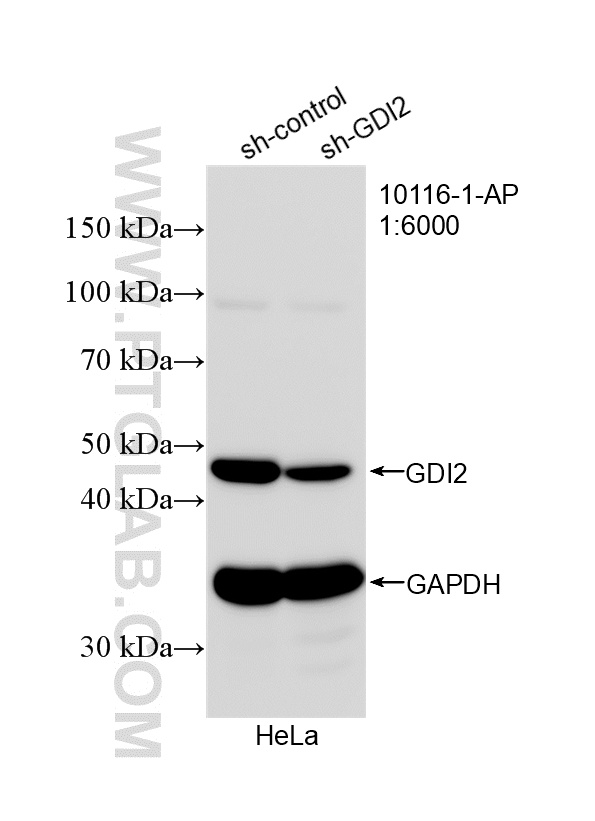 WB analysis of HeLa using 10116-1-AP WB analysis of HeLa using 10116-1-AP