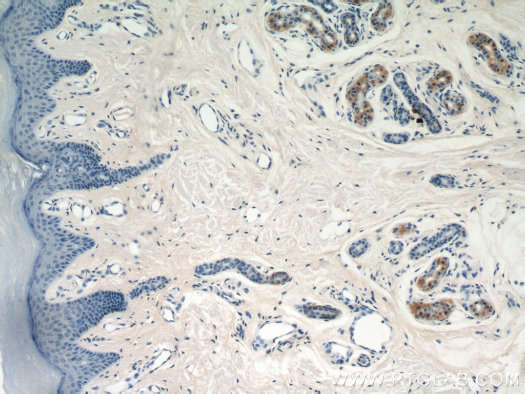 IHC staining of human skin using 55096-1-AP