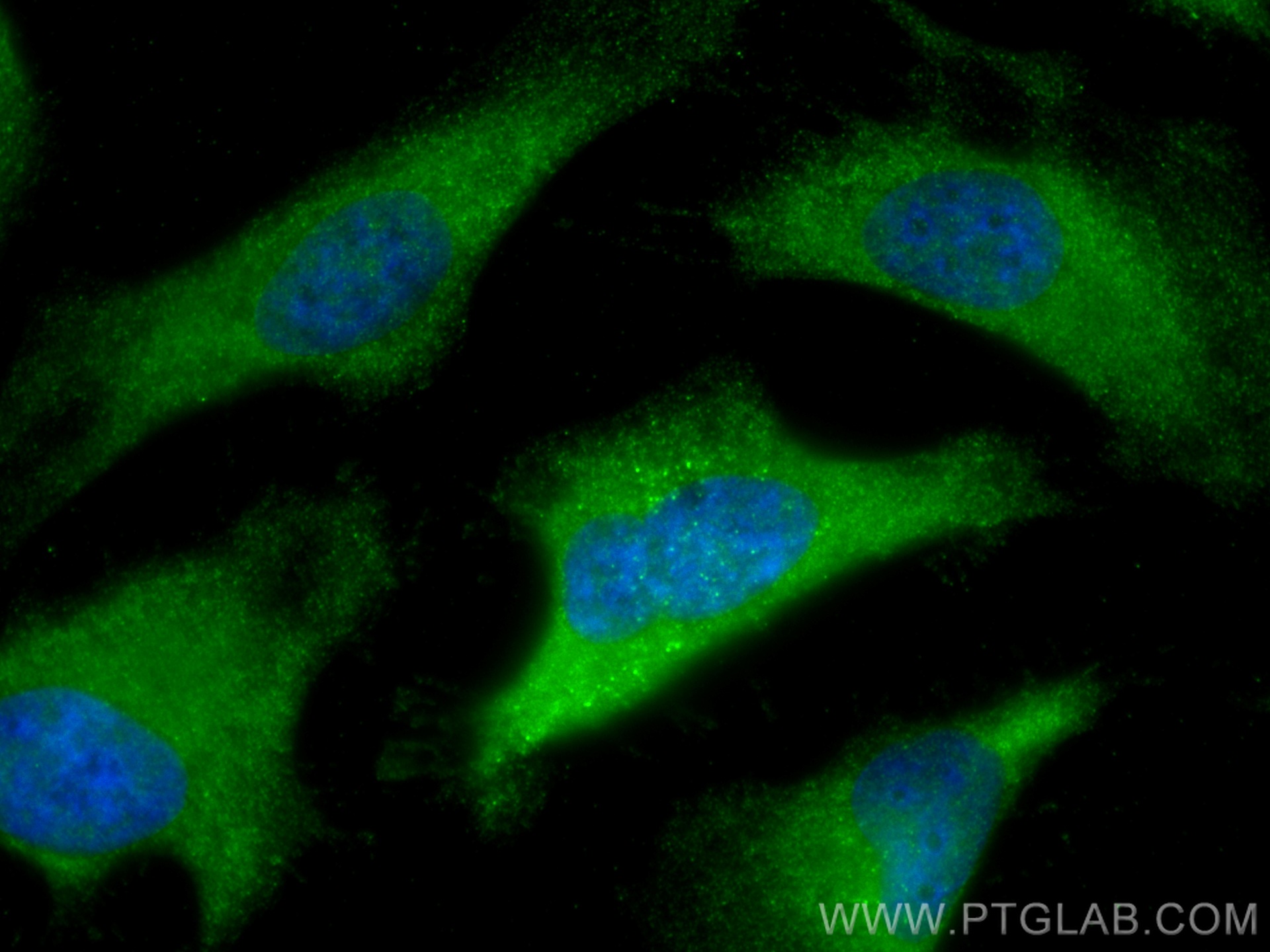 IF Staining of HeLa using 60078-1-Ig (same clone as 60078-1-PBS)