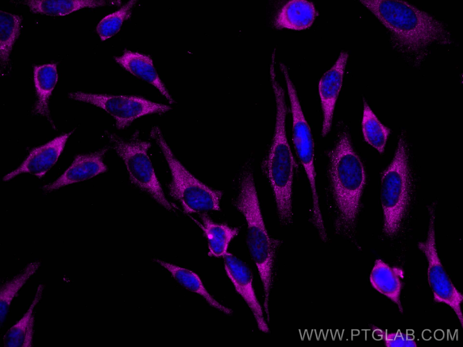 IF Staining of HeLa using CL647-60078