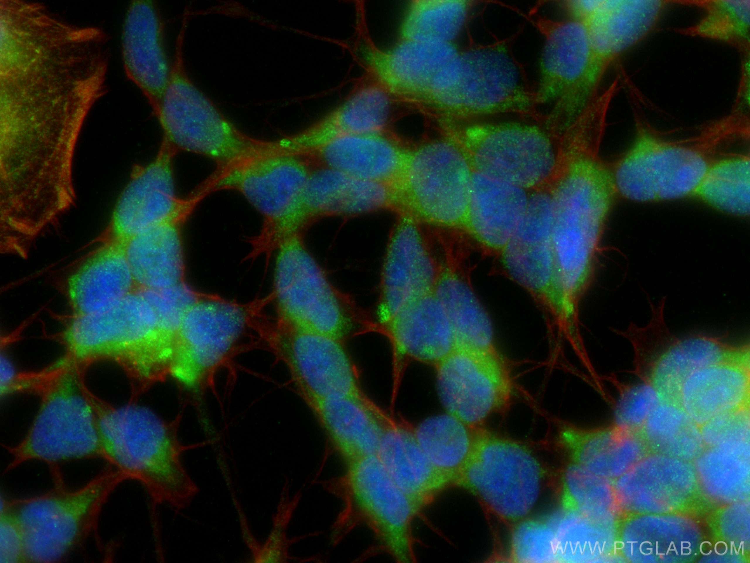 IF Staining of SH-SY5Y using 26179-1-AP