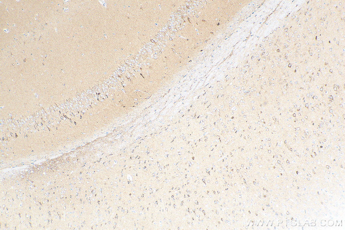 IHC staining of mouse brain using 83087-1-RR