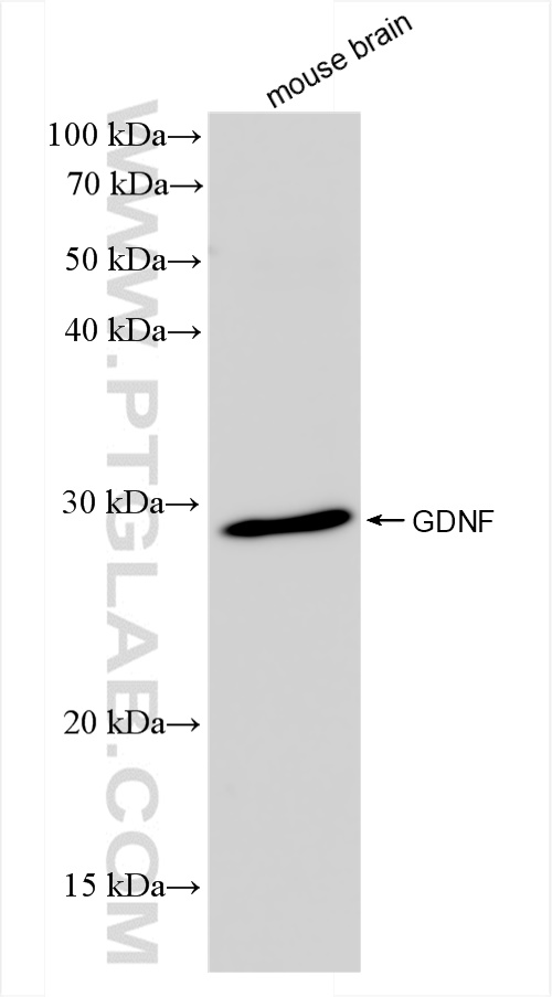 WB analysis of mouse brain using 83087-2-RR (same clone as 83087-2-PBS)