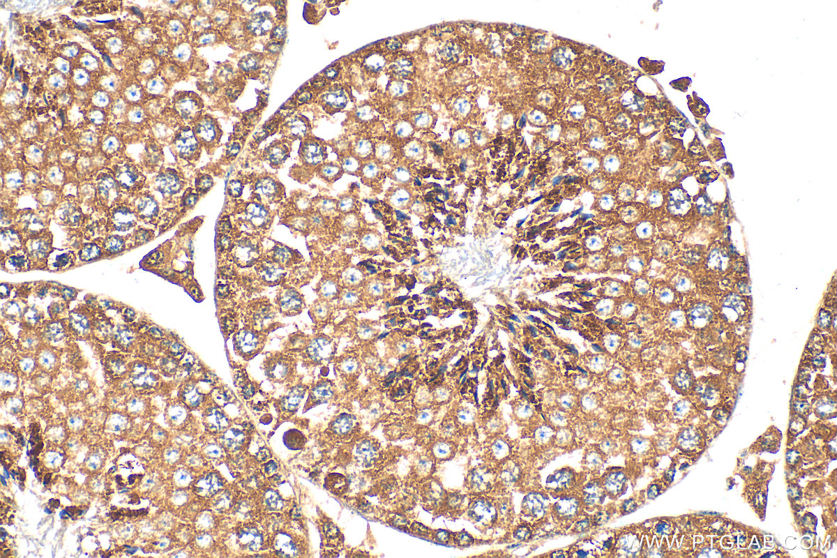 IHC staining of mouse testis using 27861-1-AP
