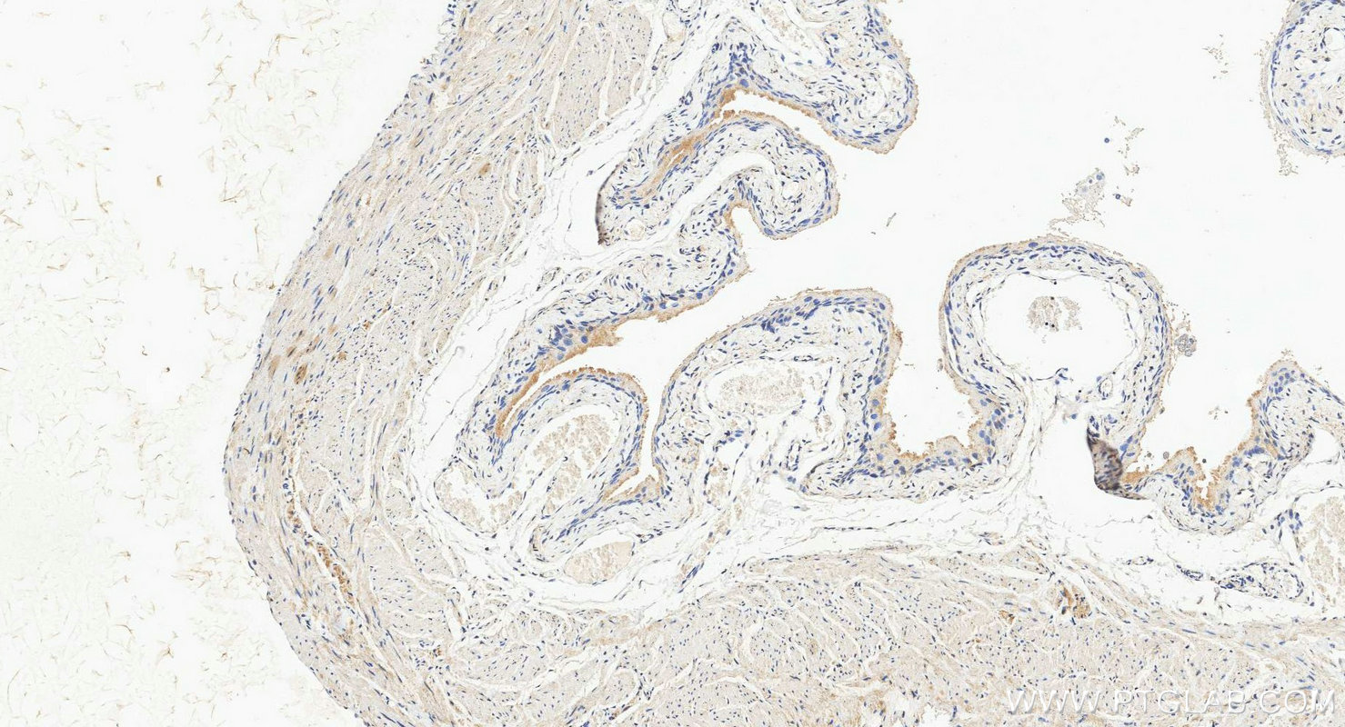 IHC staining of mouse bladder using 20390-1-AP IHC staining of mouse bladder using 20390-1-AP