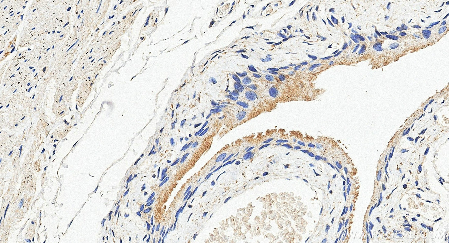 IHC staining of mouse bladder using 20390-1-AP IHC staining of mouse bladder using 20390-1-AP