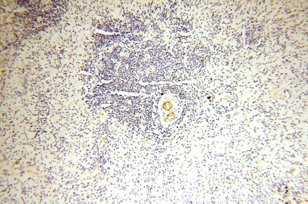 IHC staining of human spleen using 16494-1-AP
