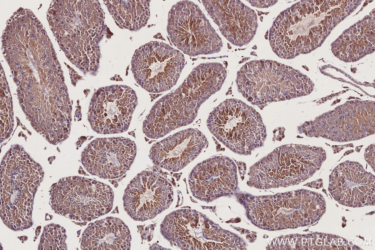 IHC staining of mouse testis using 24472-1-AP IHC staining of mouse testis using 24472-1-AP