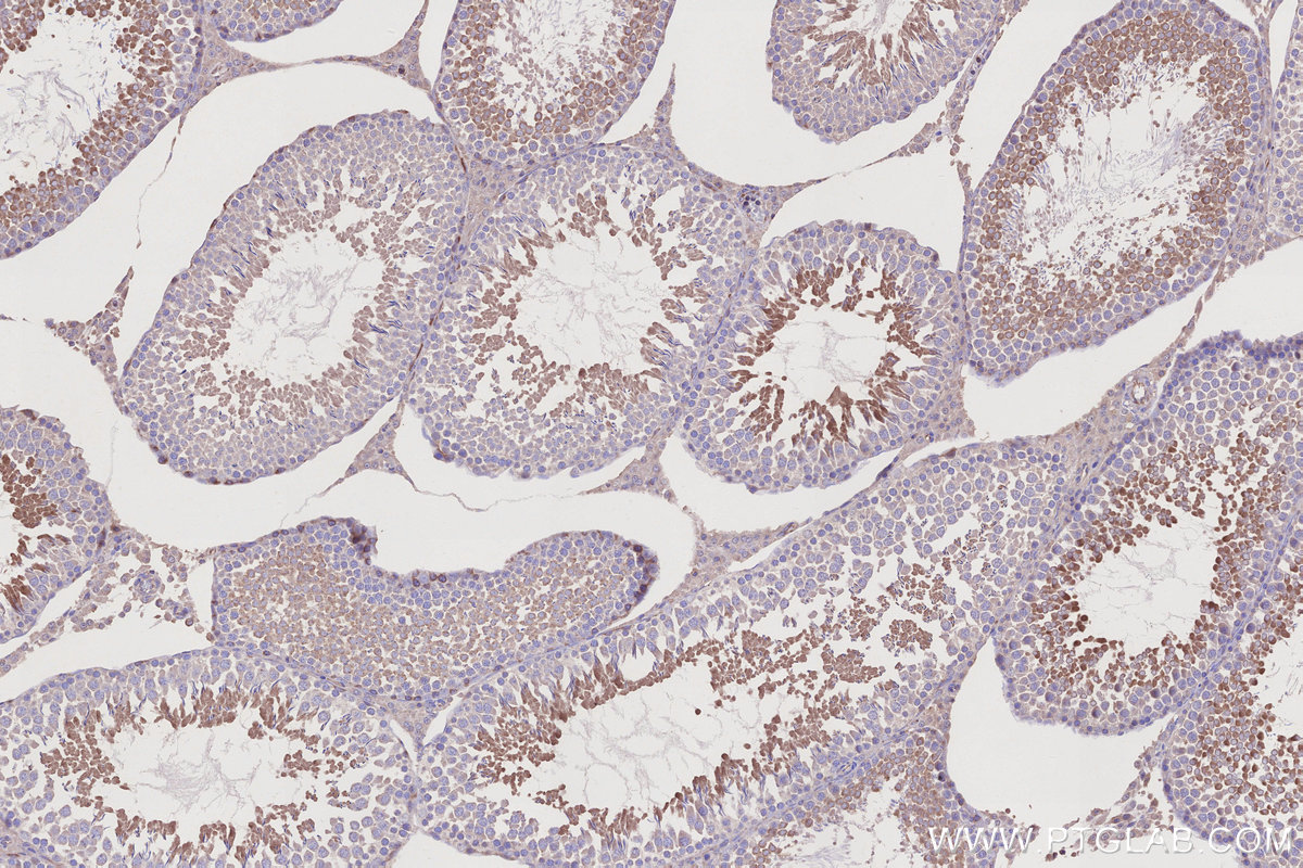 IHC staining of rat testis using 24472-1-AP IHC staining of rat testis using 24472-1-AP