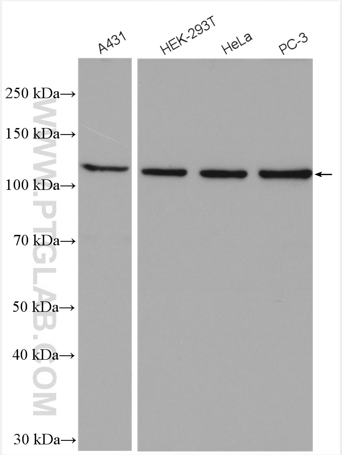 WB analysis using 24472-1-AP