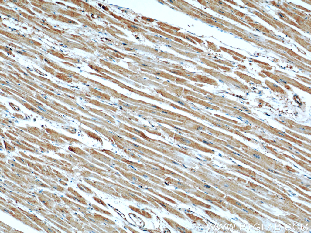 IHC staining of human heart using 66012-1-Ig