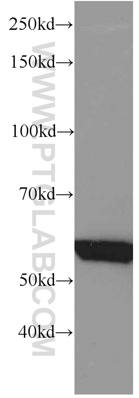 WB analysis of mouse skeletal muscle using 66012-1-Ig