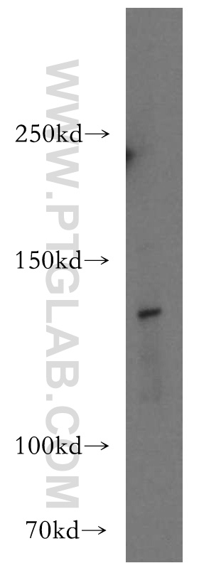 WB analysis of HEK-293 using 12408-1-AP