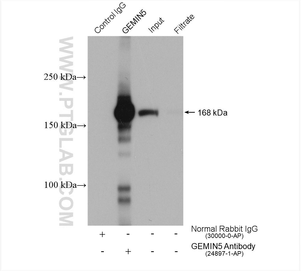 IP experiment of HeLa using 24897-1-AP