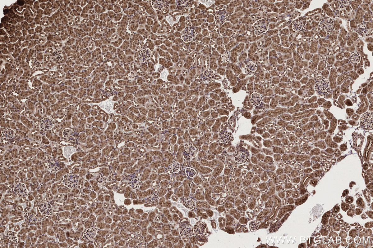 IHC staining of mouse kidney using 84171-5-RR IHC staining of mouse kidney using 84171-5-RR