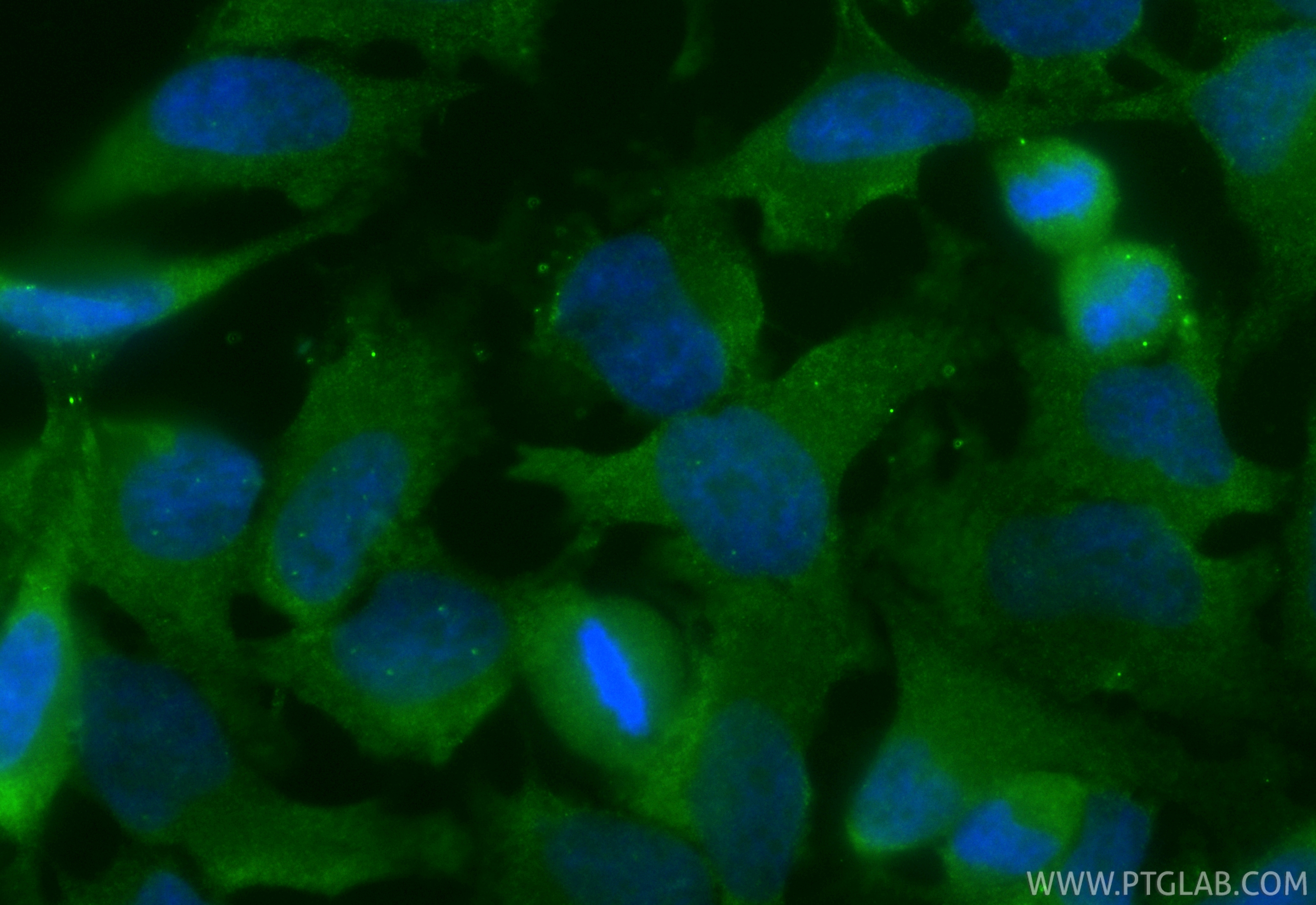 Immunofluorescent analysis of (4% PFA) fixed HeLa cells using CoraLite® Plus 488 GEMIN5 antibody (CL488-84171-5, Clone: 241205G7 ) at dilution of 1:200. IF Staining of HeLa using CL488-84171-5