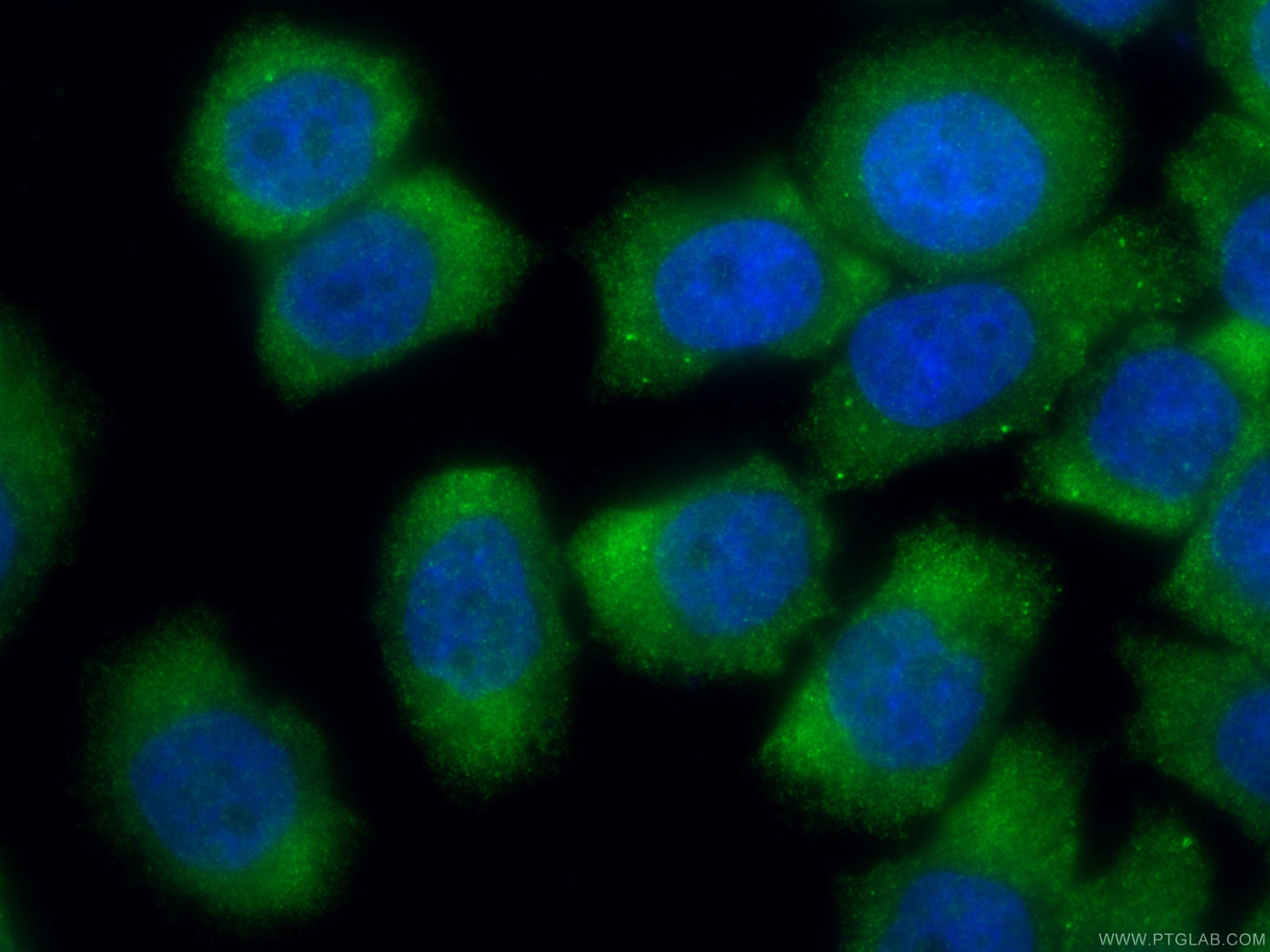 IF Staining of PC-3 using 12307-2-AP