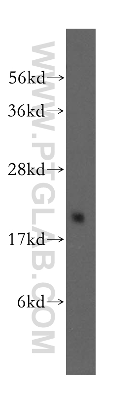 GEMIN6 Polyclonal antibody