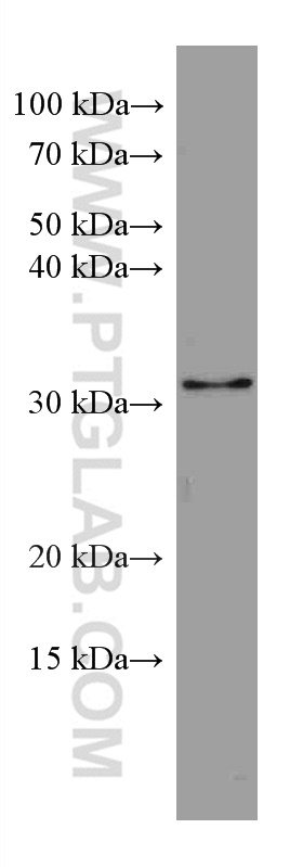 WB analysis of HeLa using 67871-1-Ig