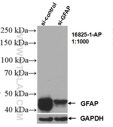 WB analysis of U-251 using 16825-1-AP