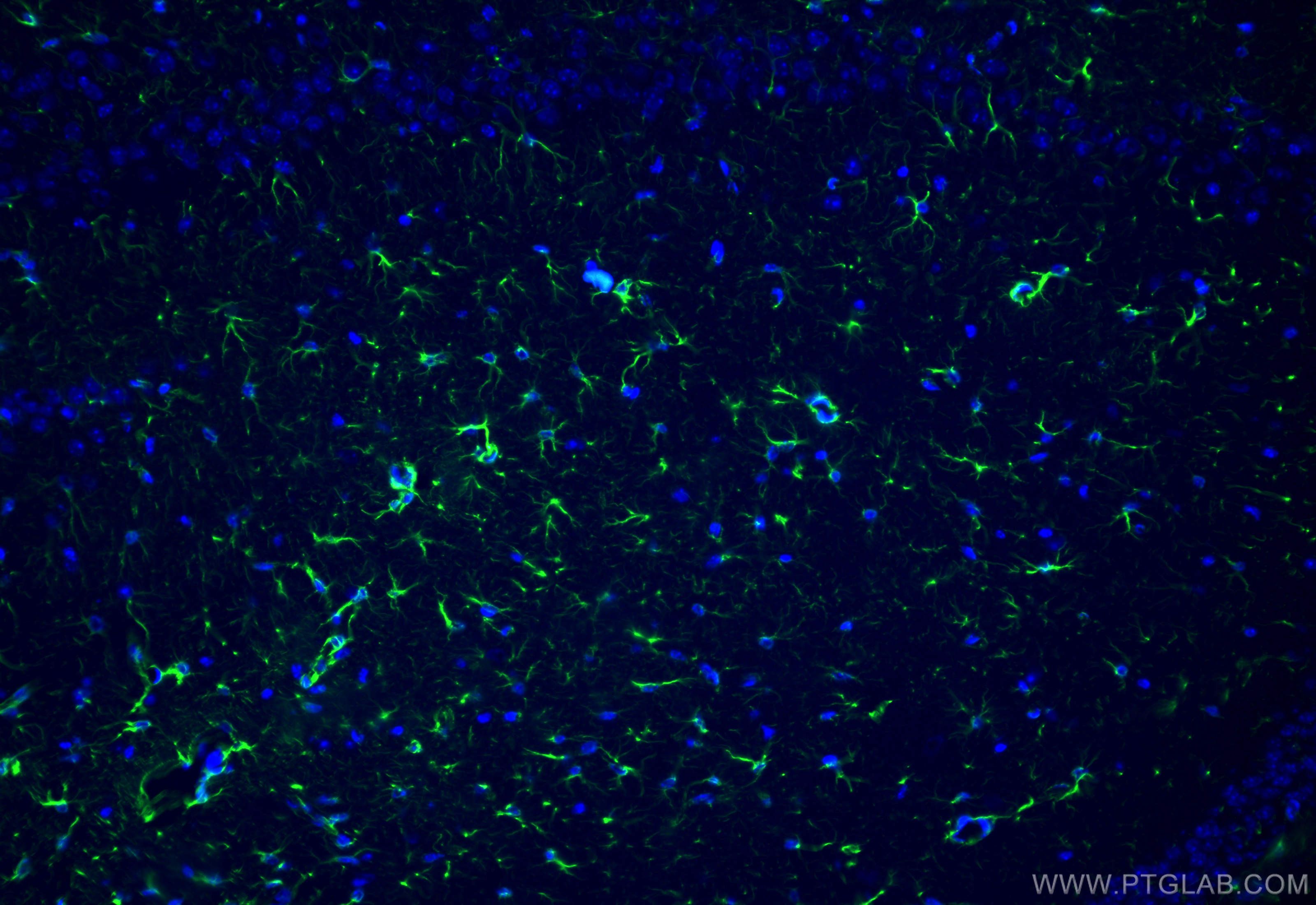 IF Staining of mouse brain using 23935-1-AP