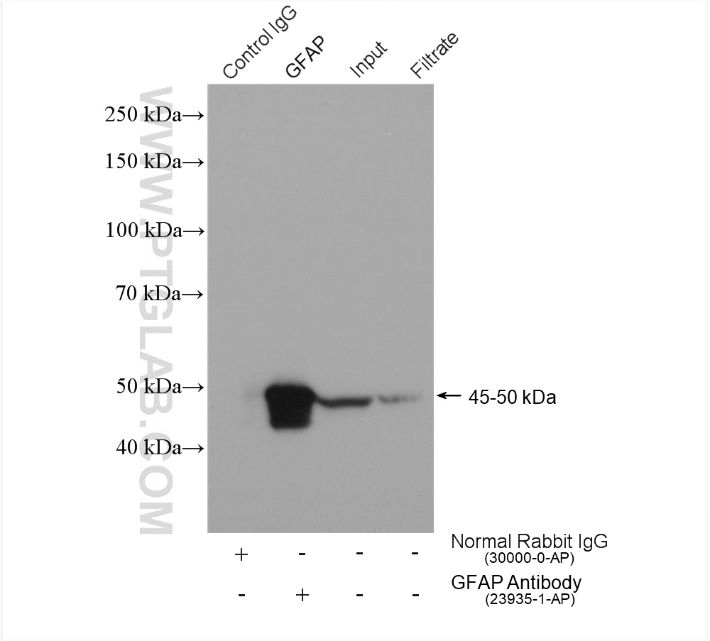 IP experiment of mouse brain using 23935-1-AP