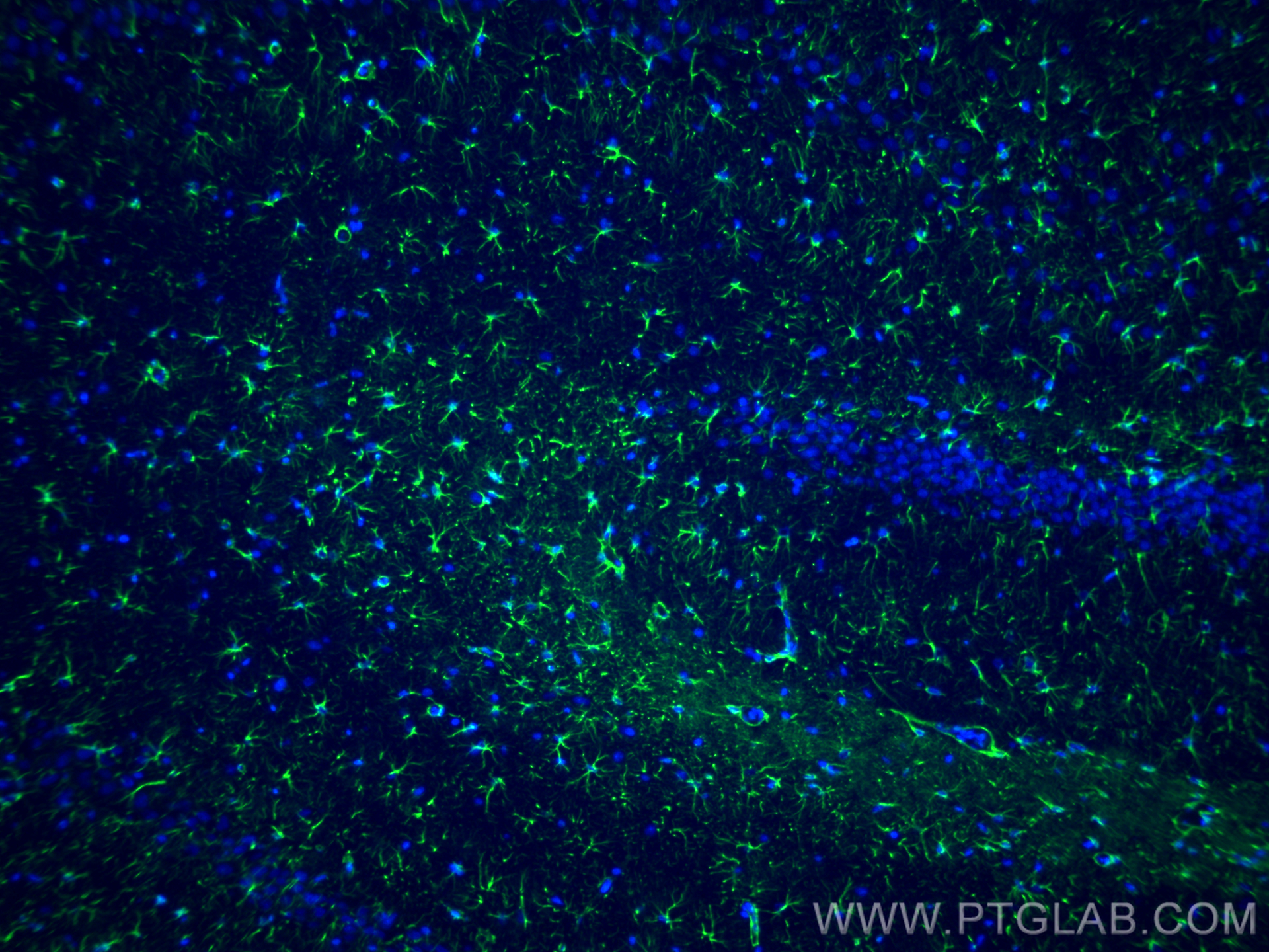 IF Staining of rat brain using 60190-1-Ig