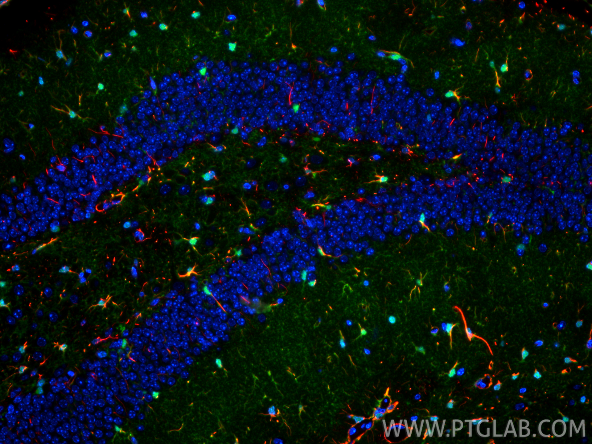 Immunofluorescent analysis of (4% PFA) fixed paraffin-embedded mouse brain tissue using GFAP antibody (60190-1-Ig, Clone: 4B2E10 ) at dilution of 1:400 and CoraLite®594-Conjugated Goat Anti-Mouse IgG(H+L) (<a class='green' href='/productredirect?CatalogNo=SA00013-3' target='_blank'>SA00013-3</a>), S100B antibody (<a class='green' href='/productredirect?CatalogNo=82271-8-RR' target='_blank'>82271-8-RR</a>, Clone: 1E2, green). Heat mediated antigen retrieval with Tris-EDTA buffer (pH 9.0). IF Staining of mouse brain using 60190-1-Ig