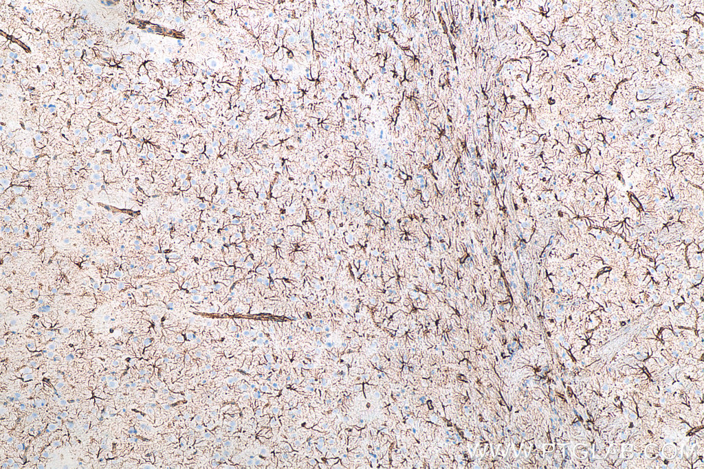 IHC staining of rat brain using 60190-1-Ig IHC staining of rat brain using 60190-1-Ig