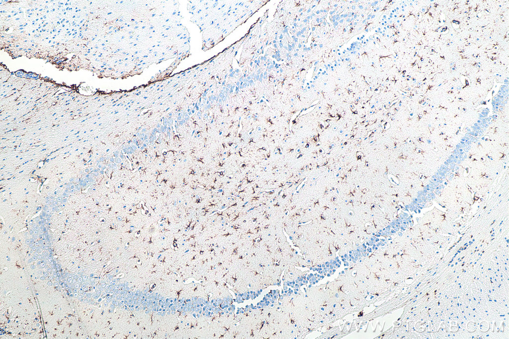 IHC staining of mouse brain using 60190-1-Ig IHC staining of mouse brain using 60190-1-Ig